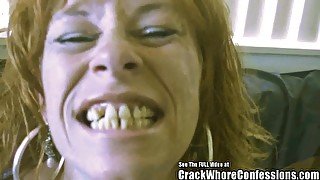 Donkey Teeth Red Head mom Crack Slut